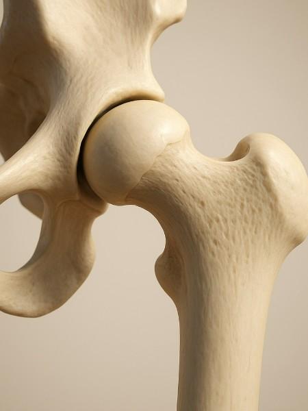 conflit fémoro acétabulaire antérieur conflit fémoro acétabulaire antérieur